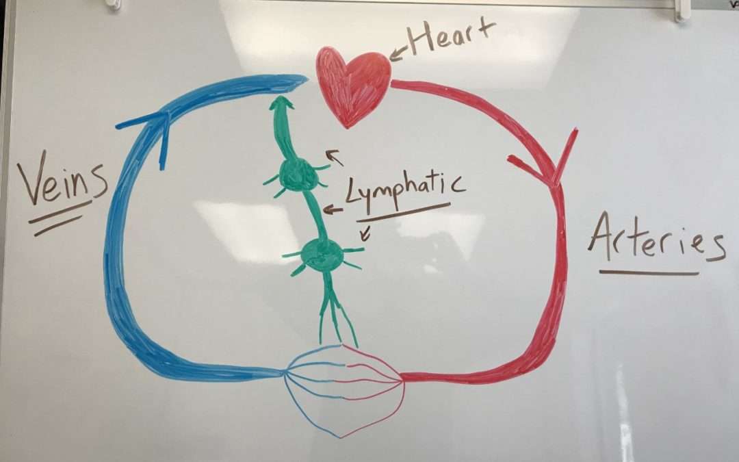 What is “Lymphedema”? (Intro to Lymphatic System)