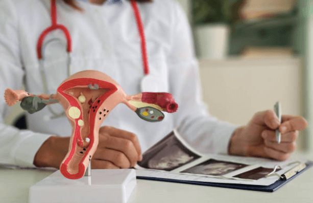 Managing Endometriosis Pain Through Movement