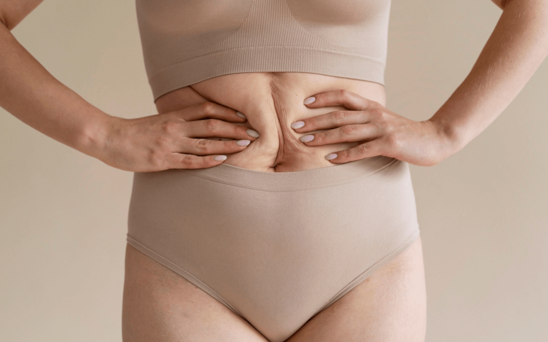 Healing Diastasis Recti – Physical Therapy for Postpartum Core Recovery