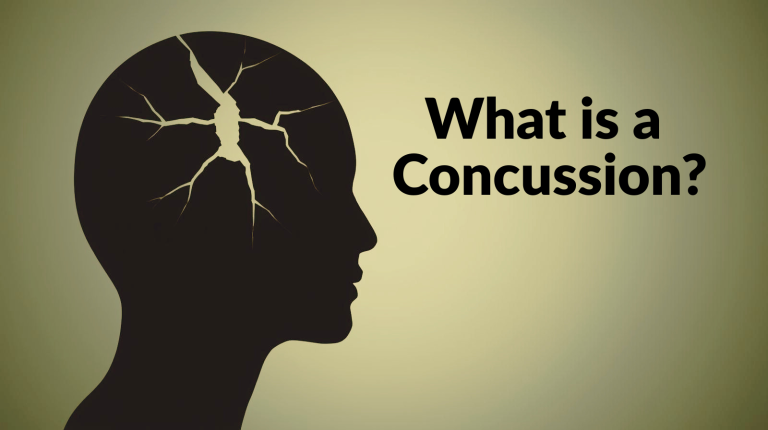 What is a Concussion A Physical therapist explains